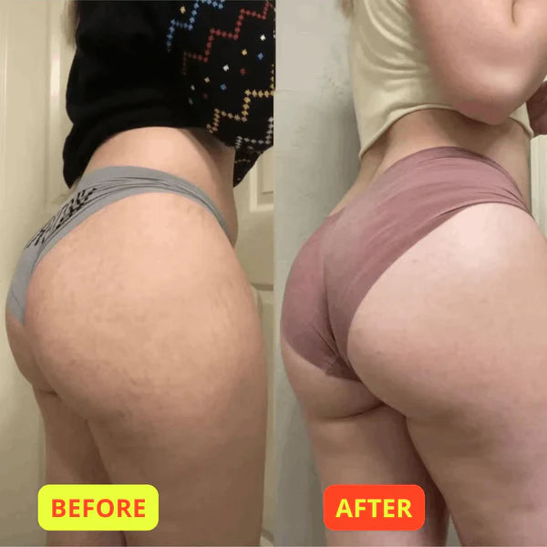 BC™ Booty Blaster